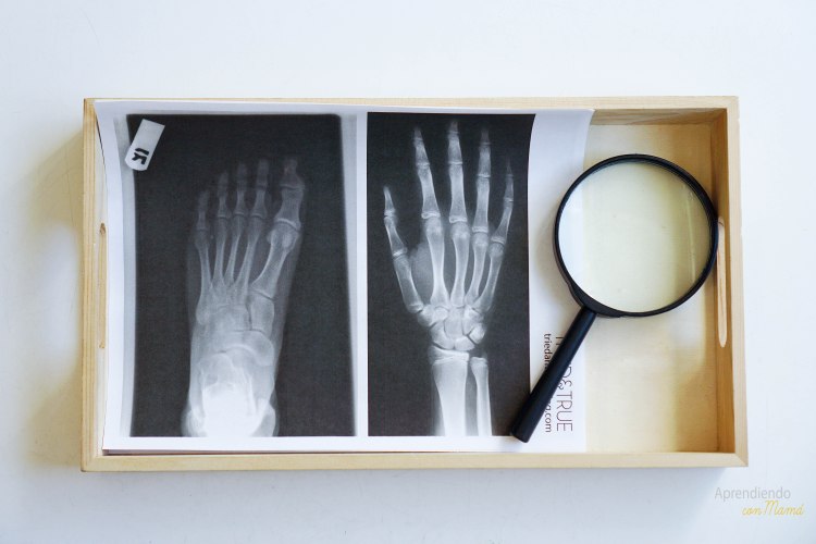 x-rays. Radiografias para tem preescolar sobre el esqueleto