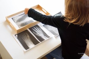 x-rays. Radiografias para tem preescolar sobre el esqueleto